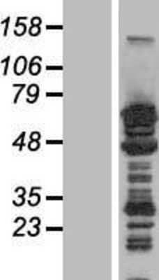 Western Blot: MAP2 Overexpression Lysate [NBP2-06122]