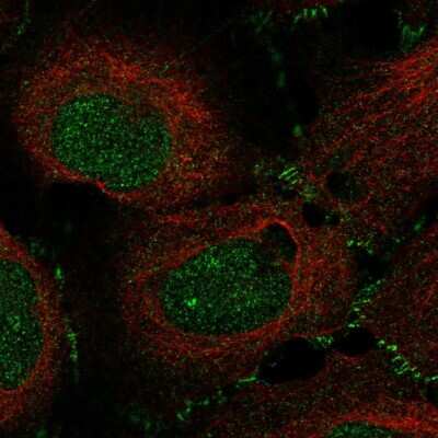 Immunocytochemistry/ Immunofluorescence: MAP3K12 Antibody [NBP2-58000]