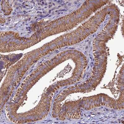 Immunohistochemistry-Paraffin: MAP3K12 Antibody [NBP1-85013]