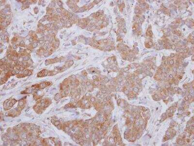 Immunohistochemistry-Paraffin: MAP3K12 Antibody [NBP2-17218]