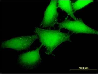 Immunocytochemistry/ Immunofluorescence: MAP3K12 binding inhibitory protein 1 Antibody (2E2) [H00051562-M05]