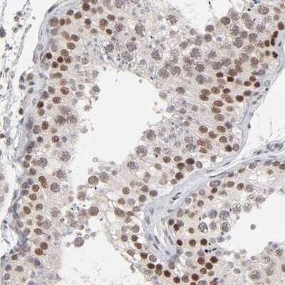 Immunohistochemistry-Paraffin: MAP3K12 binding inhibitory protein 1 Antibody [NBP1-85805]