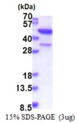 SDS-PAGE: Recombinant Human MAP3K12 binding inhibitory protein 1 His Protein [NBP2-23216]