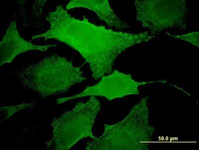 Immunocytochemistry/ Immunofluorescence: MAP3K13 Antibody (4H7) [H00009175-M04]