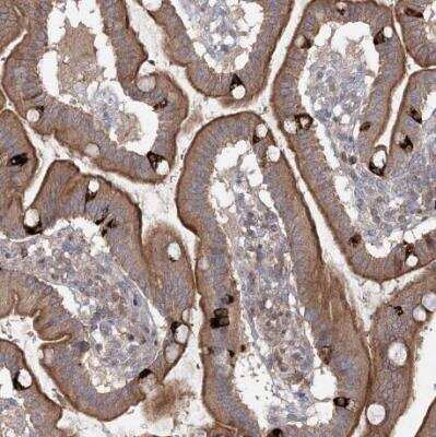 Immunohistochemistry-Paraffin: MAP3K13 Antibody [NBP1-81272]