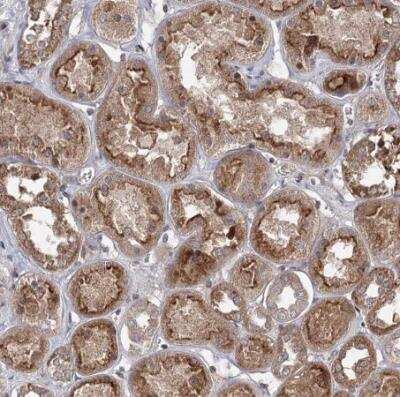 Immunohistochemistry-Paraffin: MAP3K13 Antibody [NBP1-81272]
