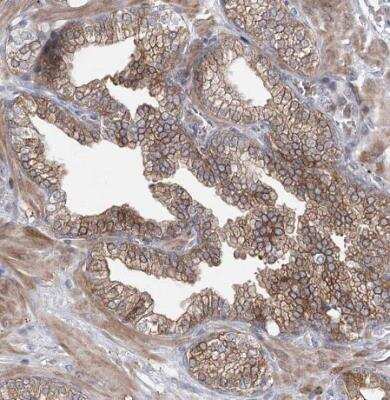 Immunohistochemistry-Paraffin: MAP3K13 Antibody [NBP1-81272]