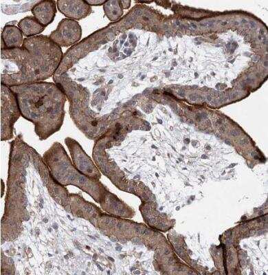 Immunohistochemistry-Paraffin: MAP3K13 Antibody [NBP1-81272]