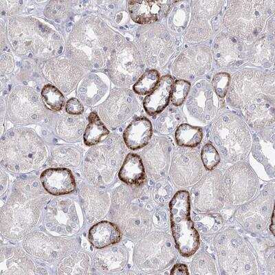 Immunohistochemistry-Paraffin: MAP3K13 Antibody [NBP1-81273]