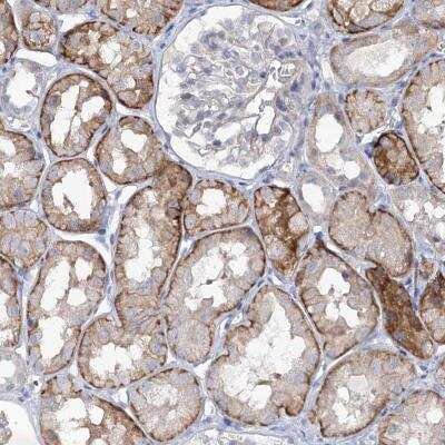 Immunohistochemistry-Paraffin: MAP3K13 Antibody [NBP1-81274]