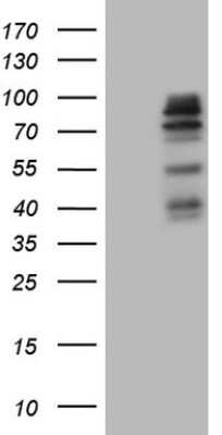 Western Blot: MAP3K15 Antibody (OTI1G10) [NBP2-45740]