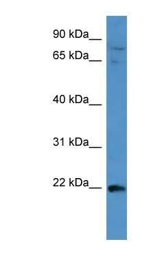 Western Blot: MAP3K15 Antibody [NBP1-52971]