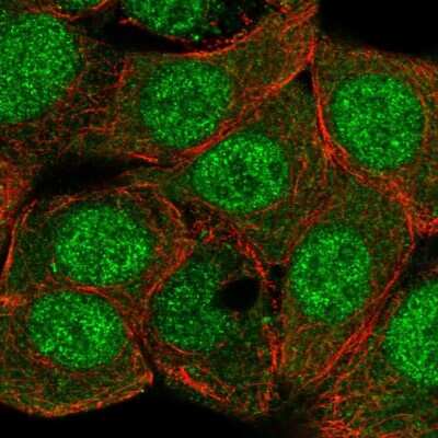 Immunocytochemistry/ Immunofluorescence: MAP3K6 Antibody [NBP2-14219]