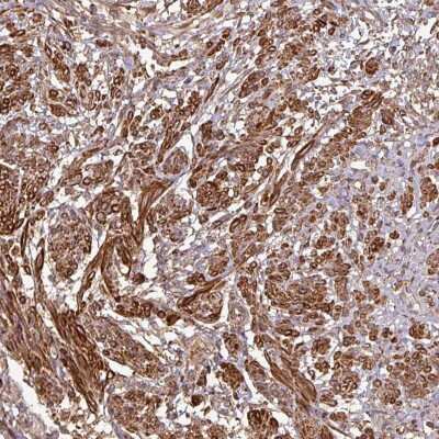 Immunohistochemistry-Paraffin: MAP3K6 Antibody [NBP2-14219]