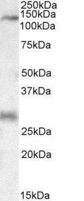 Western Blot: MAP3K6 Antibody [NBP1-51977]