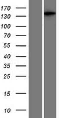 Western Blot: MAP3K6 Overexpression Lysate [NBP2-07839]