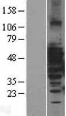 Western Blot: MAP3K8/Tpl2/COT Overexpression Lysate [NBL1-12859]