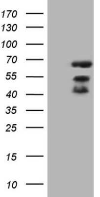 Western Blot: MAP3K8/Tpl2/COT Antibody (OTI3D9) [NBP2-45741]