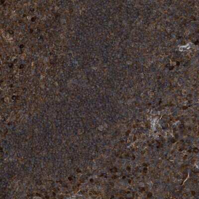 Immunohistochemistry-Paraffin: MAP3K8/Tpl2/COT Antibody [NBP1-86569]