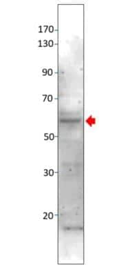 Western Blot: MAP3K8/Tpl2/COT Antibody [NBP1-62178]