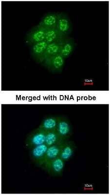 Immunocytochemistry/ Immunofluorescence: MAP3K9 Antibody [NBP1-33704]