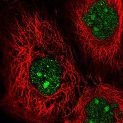 Immunocytochemistry/ Immunofluorescence: MAP3K9 Antibody [NBP1-82781]