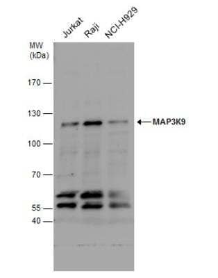 Western Blot: MAP3K9 Antibody [NBP1-33704]