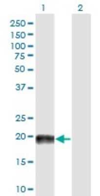 Western Blot: MAP4 Antibody (7C9) [H00004134-M03]