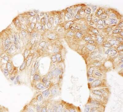 Immunohistochemistry: MAP4 Antibody [NB100-74616]