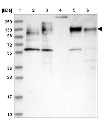 Western Blot: MAP4 Antibody [NBP1-89483]