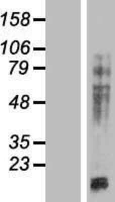 Western Blot: MAP4 Overexpression Lysate [NBP2-06172]