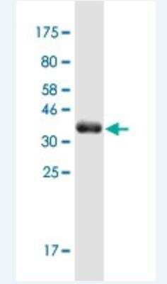 Western Blot: MAP4K1 Antibody (1G6) [H00011184-M02-100ug]