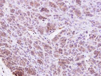 Immunohistochemistry-Paraffin: MAP4K1 Antibody [NBP1-31000]