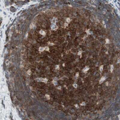 Immunohistochemistry-Paraffin: MAP4K1 Antibody [NBP1-83221]