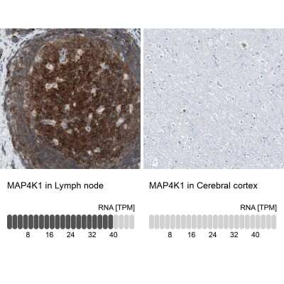 Immunohistochemistry-Paraffin: MAP4K1 Antibody [NBP1-83221]