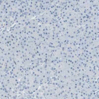 Immunohistochemistry-Paraffin: MAP4K1 Antibody [NBP1-83221]