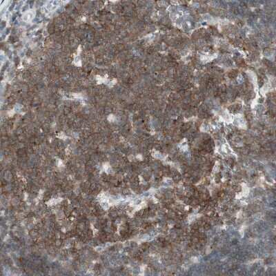 Immunohistochemistry-Paraffin: MAP4K1 Antibody [NBP1-83221]