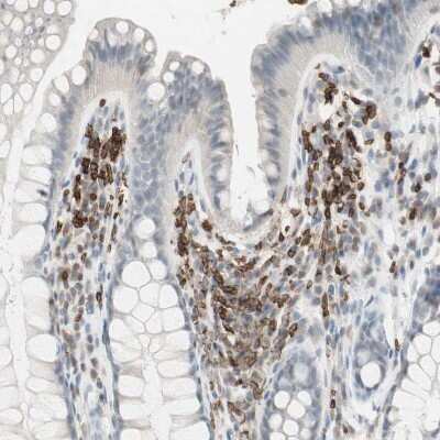 Immunohistochemistry-Paraffin: MAP4K1 Antibody [NBP1-83221]