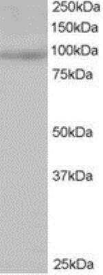 Western Blot: MAP4K1 Antibody [NB100-1045]