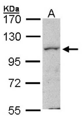 Western Blot: MAP4K1 Antibody [NBP1-31000]