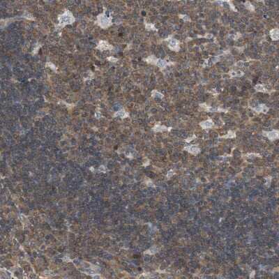 Immunohistochemistry-Paraffin: MAP4K2 Antibody [NBP1-88584]