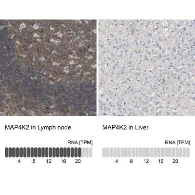 Immunohistochemistry-Paraffin: MAP4K2 Antibody [NBP1-88584]