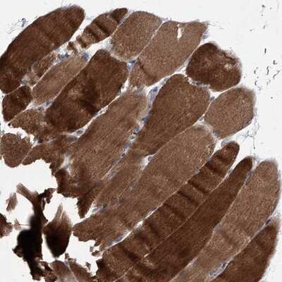 Immunohistochemistry-Paraffin: MAP4K3 Antibody [NBP1-81824]