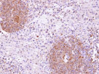 Immunohistochemistry-Paraffin: MAP4K5 Antibody [NBP1-31234]