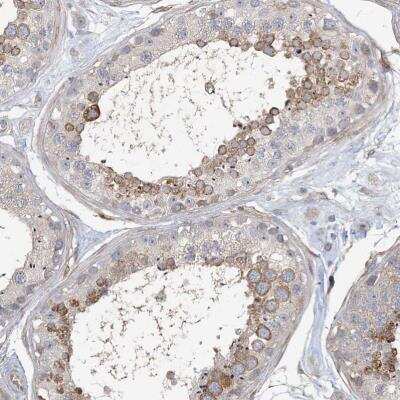Immunohistochemistry-Paraffin: MAP4K5 Antibody [NBP1-83385]