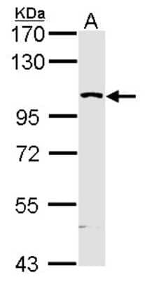 Western Blot: MAP4K5 Antibody [NBP1-31234]