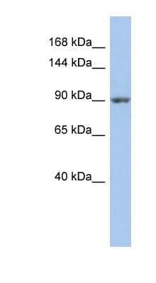 Western Blot: MAP4K5 Antibody [NBP1-58850]