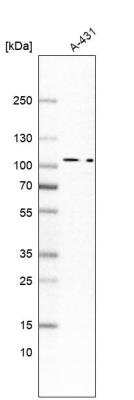 Western Blot: MAP4K5 Antibody [NBP1-83385]