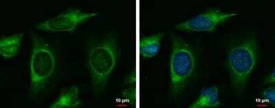 Immunocytochemistry/ Immunofluorescence: MAP4K6 Antibody [NBP1-32766]