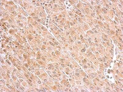 Immunohistochemistry-Paraffin: MAP4K6 Antibody [NBP1-32766]